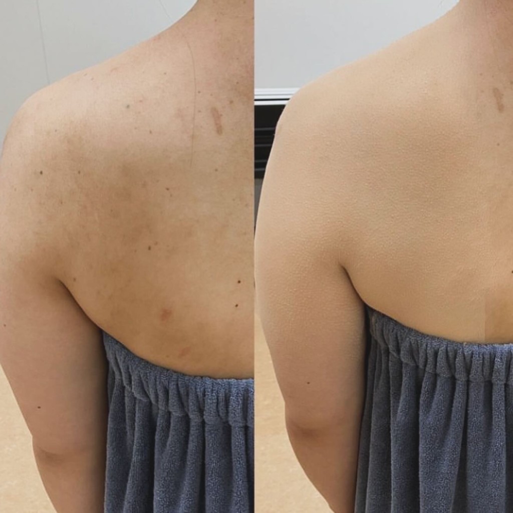 大分県 エアブラシメイクで肌のくすみをカバーした結婚式用ベースメイク リハーサル