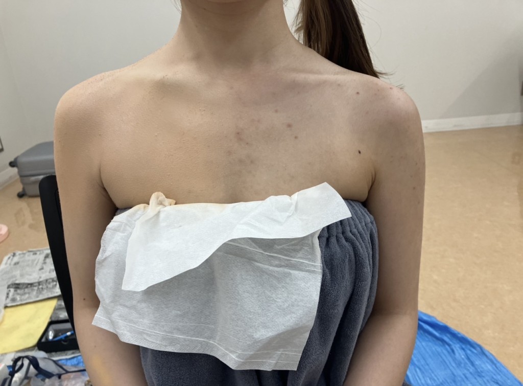 大分県で結婚式を挙げる方、エアブラシメイクで肌のくすみを整え、均一で明るい印象の肌に仕上げたベースメイクです。ボディーカバーメイク