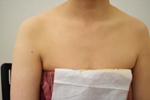 大分県結婚式カバーメイク 大分県でエアブラシメイクにより肌のくすみを自然にカバーしたブライダルメイク• 結婚式前の肌くすみを整えたエアブラシメイク施術例 • ドレス姿の花嫁の肌くすみを均一に整えたエアブラシカバーメイク • 大分県で肌トラブルやくすみをカバーしたブライダルメイク 白斑カバーメイク