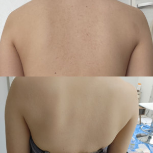 大分県 結婚式 大分県結婚式