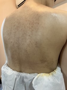 「特別な日の自信をサポートするボディーカバーメイク」大分県で数少ないボディーメイクを行っています。シミやニキビ跡が気になる方、写真映りを良くしたい方、背中を出したくない方、刺青を隠したい方など、堂々と素肌を見せられない方も多いかと思います。エアブラシメイクは刺青も隠すことができる特殊メイクです。
まずはリハーサルメイクをお試しいただけるので、公式LINEから直接お問い合わせください。
式の日程は土日に集中しがちですので、早めのご連絡をおすすめしております。#大分県結婚式#大分県#西大分結婚式#結婚式#ブライダル#ドレス姿#大分ウエディングドレス#ウエディングドレス#ボディーカバー#ブライダルボディーメイク#ブライダルトラブル#結婚式ドレス #別府#別府結婚式