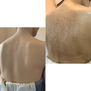 大分県 エアブラシメイクでニキビ跡や肌荒れをカバーした結婚式メイク