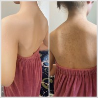 大分県でエアブラシメイクによるカバーメイクを行っています。刺青カバーや肌トラブルカバーなど結婚式や撮影前のメイクにも対応しています。