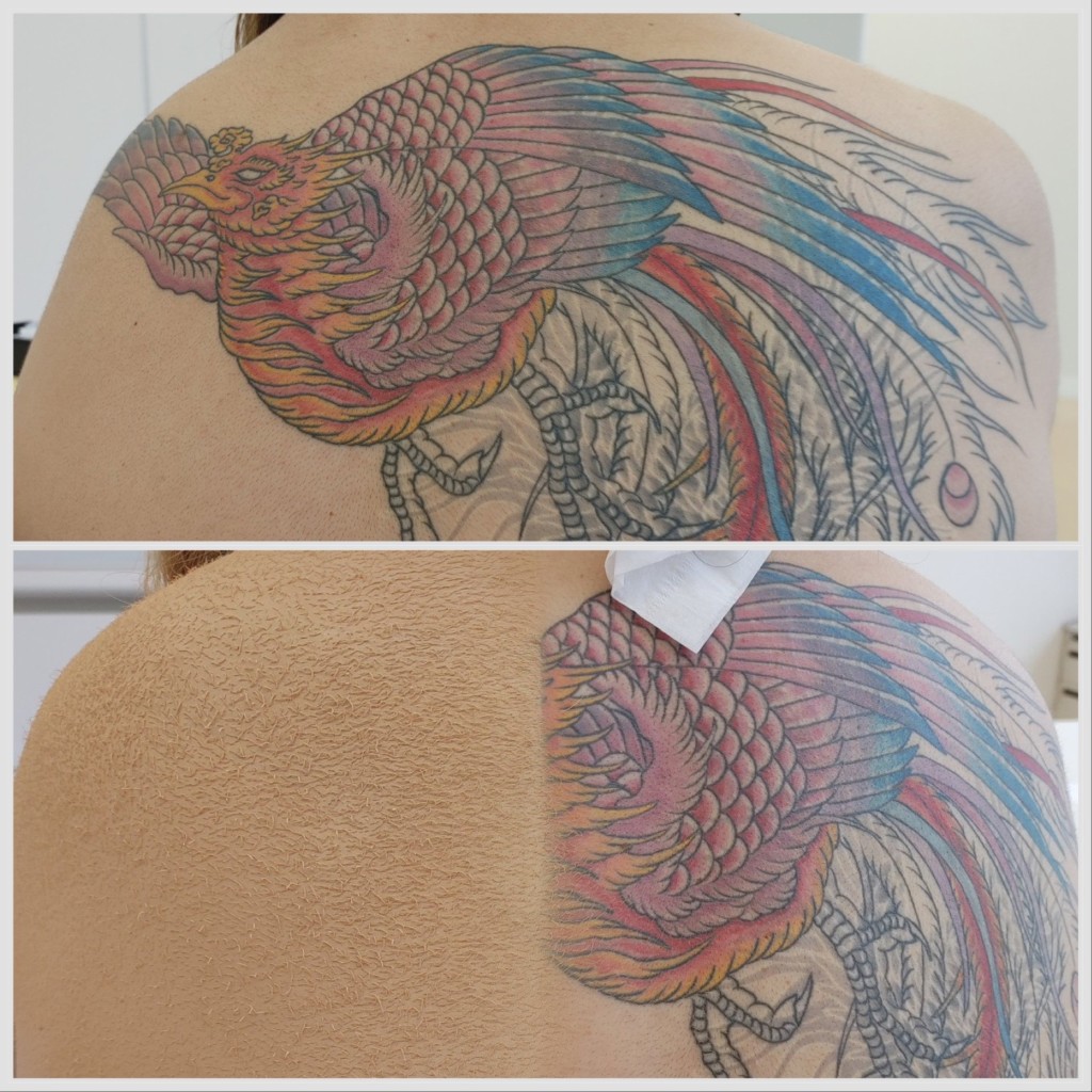 大分県刺青カバーメイク　エアブラシ　リハーサル