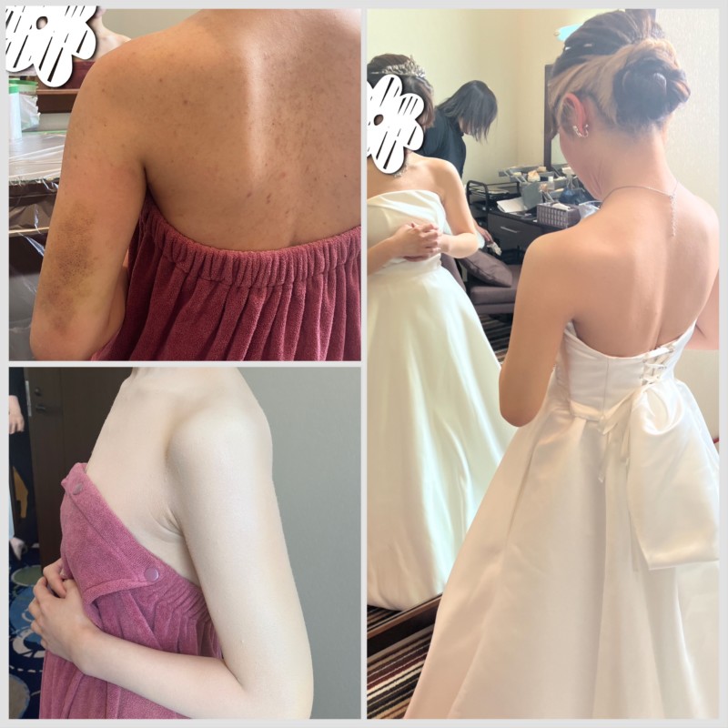 #大分県結婚式#大分県#西大分結婚式#結婚式#ブライダル#ドレス姿#大分ウエディングドレス#ウエディングドレス#ボディーカバー#ブライダルボディーメイク#ブライダルトラブル#結婚式ドレス #別府#別府結婚式