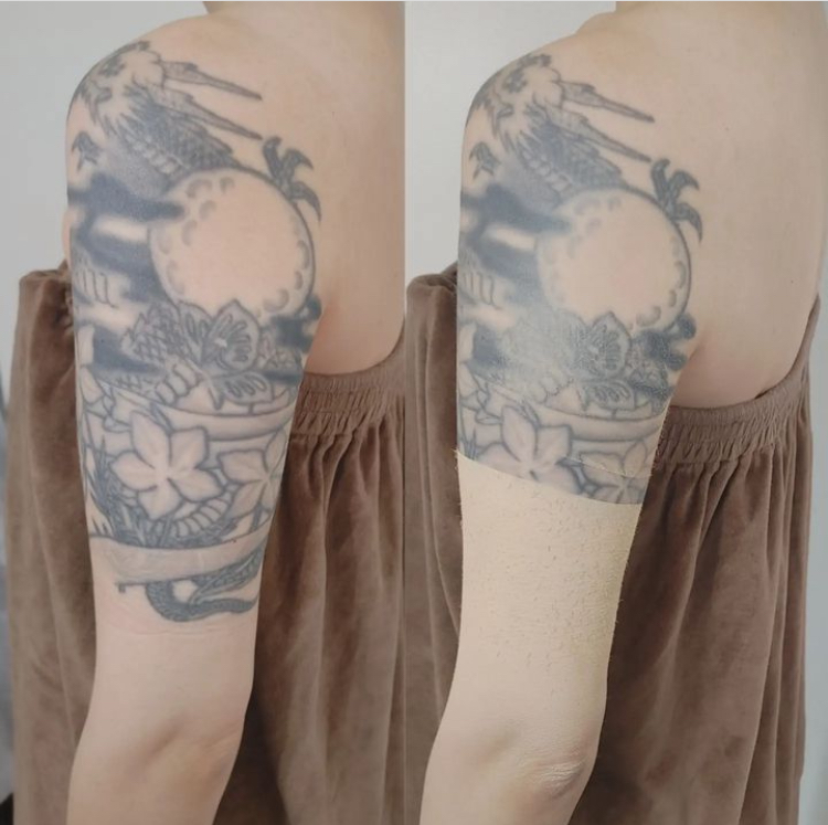 大分県 #大分前撮り #大分ウエディング#結婚式 #ブライダルカバーメイク大分 #ウエディングドレス #大分県結婚式#刺青カバー#タトゥーカバー #刺青カバーメイク#結婚式ドレス